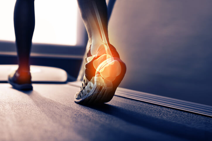 foot on treadmill 